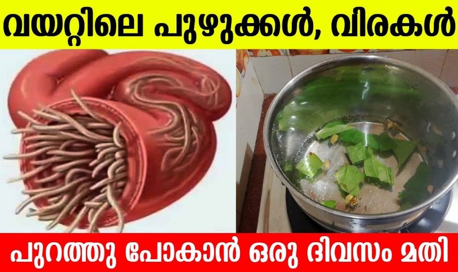 ഒരൊറ്റ ദിവസം കൊണ്ട് വിരകളെ നശിപ്പിക്കാൻ ഇതാ ഒരു സൂപ്പർ ഡ്രിങ്ക്. ഇതാരും നിസ്സാരമായി തള്ളിക്കളയരുതേ…| To Get Rid Of Intestinal Worms