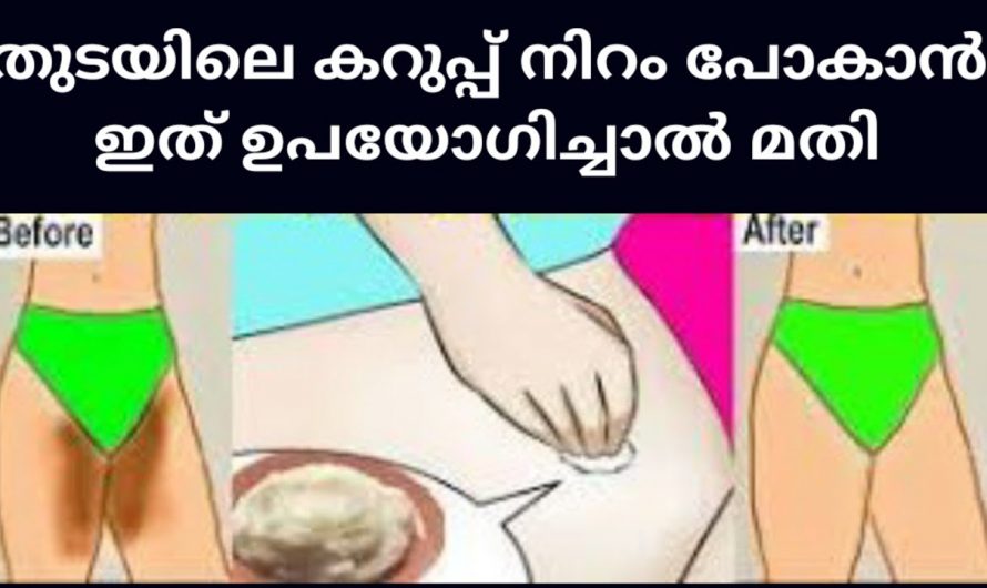 സ്വകാര്യ ഭാഗങ്ങളിലെ കറുപ്പുനിറം മാറാൻ ഈ ഒരു ഗുളിക മതി. ഇതാരും നിസ്സാരമായി തള്ളിക്കളയരുതേ.