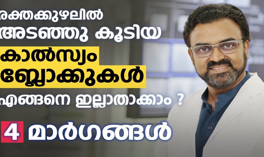 കാൽസ്യം ബ്ലോക്കുകളെ ഇല്ലായ്മ ചെയ്യുന്ന ഇത്തരം മാർഗങ്ങളെ ആരും തിരിച്ചറിയാതെ പോകല്ലേ…| Calcium build-up in blood vessels