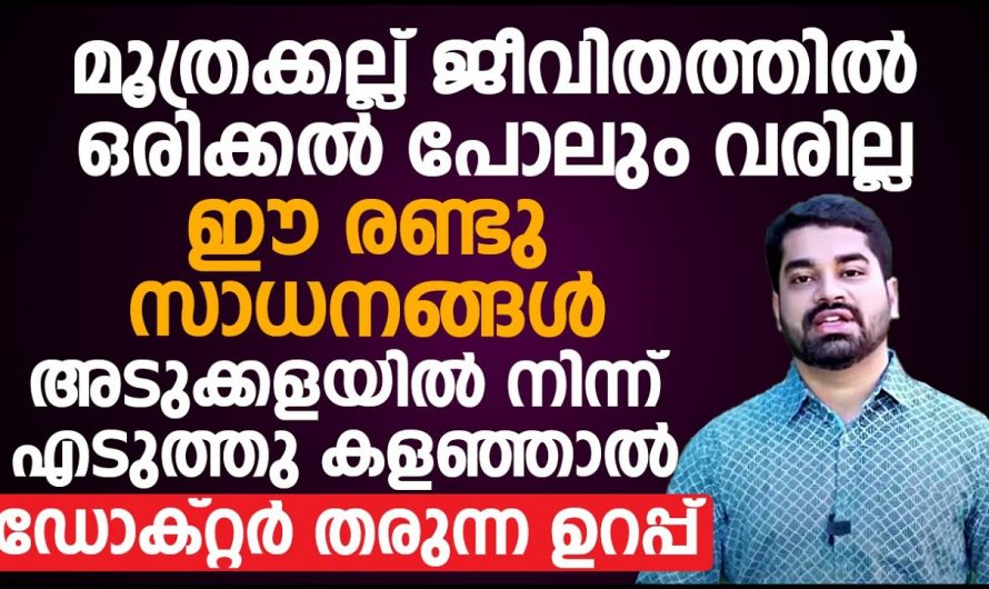 ഈ രണ്ടു സാധനങ്ങൾ എടുത്തു കളയൂ മൂത്രക്കല്ലിനെ എളുപ്പത്തിൽ പ്രതിരോധിക്കാം…| Urinary stones treatment