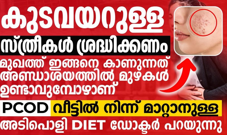 ഈ ഭക്ഷണങ്ങൾ കഴിക്കൂ പിസിഒഡിയെ പെട്ടെന്ന് തന്നെ മറികടക്കാം. ഇതാരും അറിയാതെ പോകരുതേ..| pcos malayalam diet