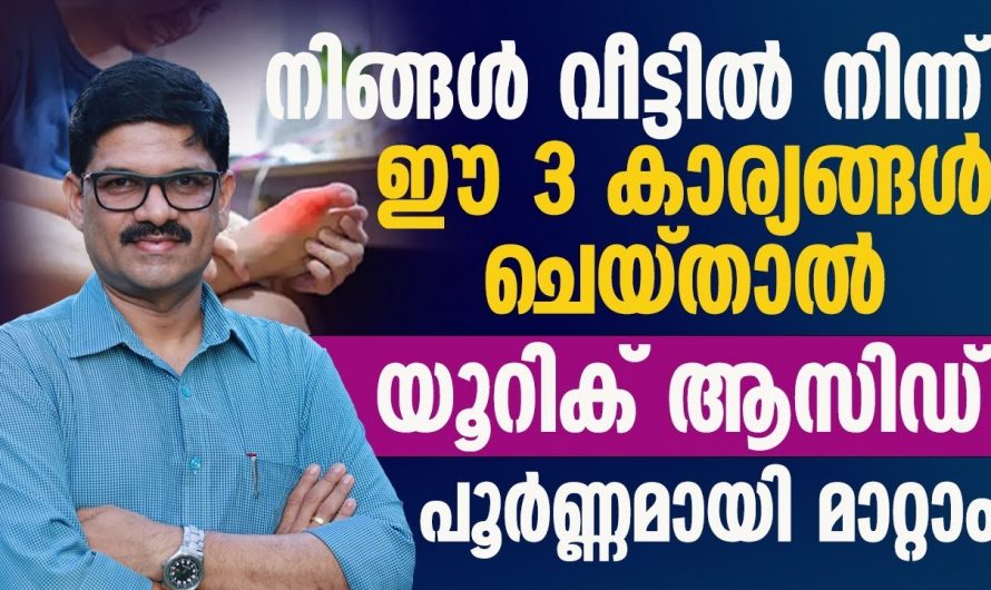 മൈഗ്രേൻ വേദനയെ കുറയ്ക്കാൻ ഇത്തരം ഭക്ഷണങ്ങൾ കഴിക്കൂ. മാറ്റം സ്വയം തിരിച്ചറിയൂ…| To reduce uric acid quickly