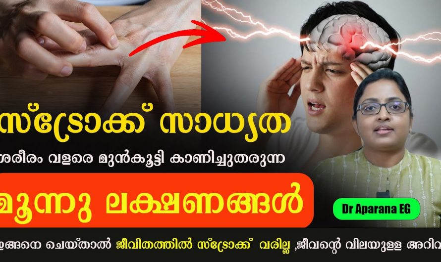 സ്ട്രോക്ക് ഒരിക്കലും നമ്മിൽ ഉണ്ടാകാതിരിക്കാൻ ഇത്തരം കാര്യങ്ങൾ ആരും നിസ്സാരമായി തള്ളിക്കളയരുതേ.