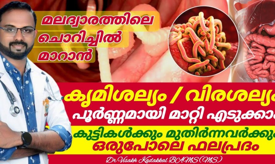 വയറിനകത്തെ എല്ലാ വിരകളെയും നശിപ്പിക്കാൻ ഇത്ര എളുപ്പമായിരുന്നോ?  ഇതാരും കാണാതെ പോകല്ലേ…| Get rid of worm infestation