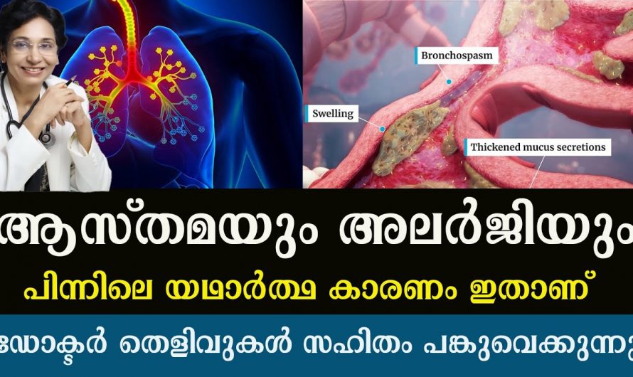 അലർജി മൂലം അസ്വസ്ഥതകൾ അനുഭവിക്കുന്നവരാണോ നിങ്ങൾ? എങ്കിൽ ഇതാരും കണ്ടില്ലെന്ന് നടിക്കരുതേ.