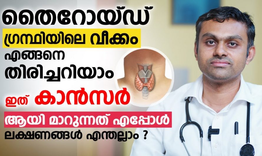 തൈറോയ്ഡ് മുഴ ക്യാൻസറായി മാറുമോ? ഇതാരും അറിയാതെ പോകല്ലേ.