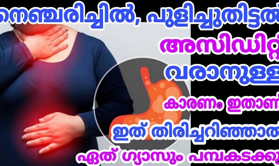 അടിക്കടി നെഞ്ചരിച്ചിൽ മൂലം ബുദ്ധിമുട്ടുന്നവരാണോ നിങ്ങൾ? എങ്കിൽ ഇത് കാണാതെ പോകല്ലേ.